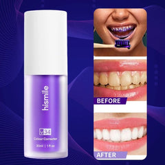 Hismile Purple Toothpaste for Teeth Whitening, Stain Removal and Colour Corrector